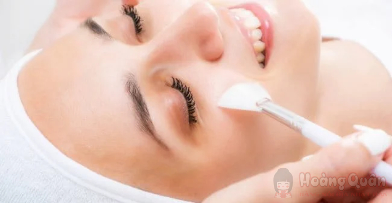 tăng sắc tố da sau peel tăng sắc tố da sau peel