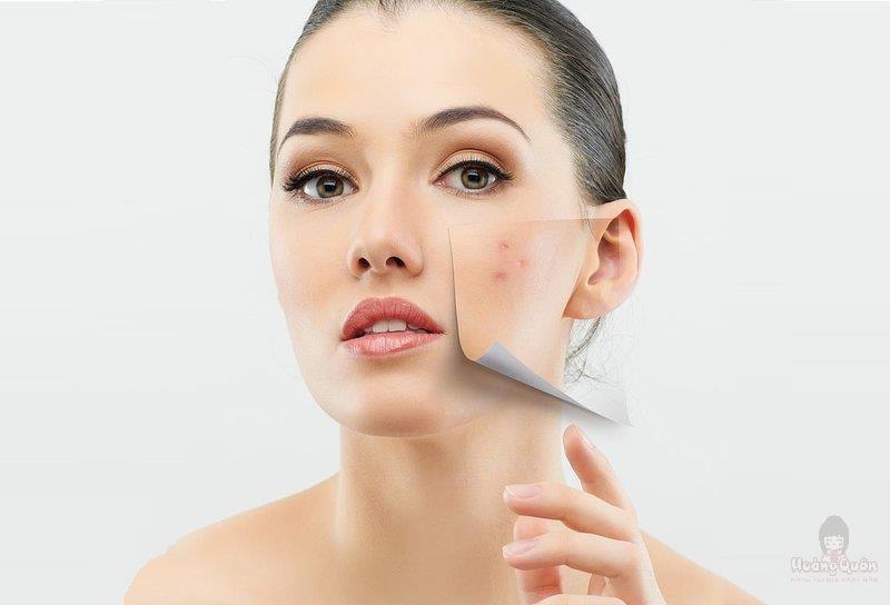 da mụn có nên dùng kem chống nắng
