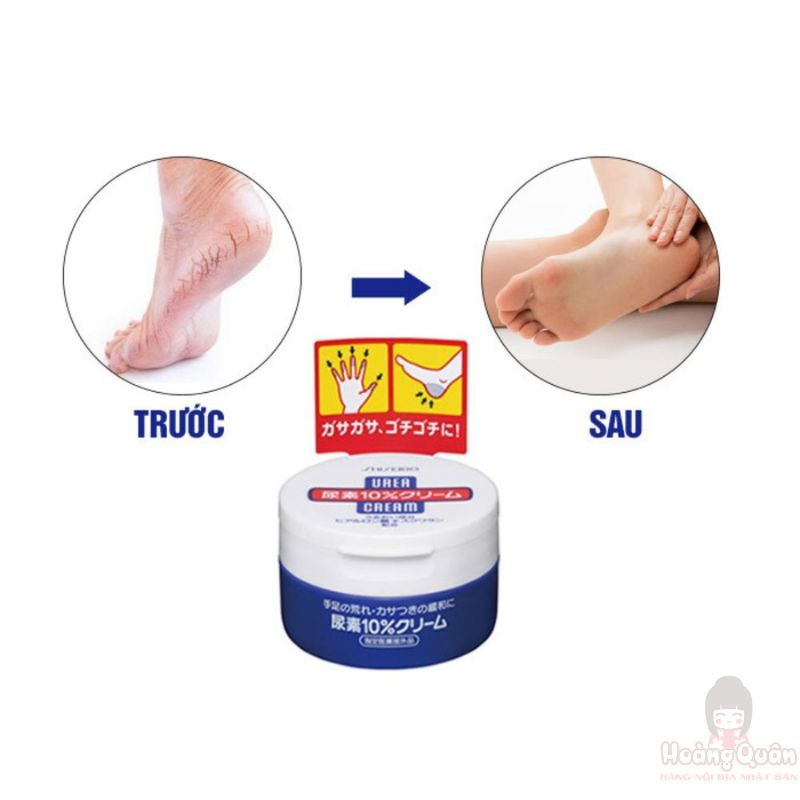 kem-tri-nut-got-chan-shiseido-urea-cream-100g-gia-re.jpg